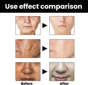 Eelhoe - Melanin Correcting Serum