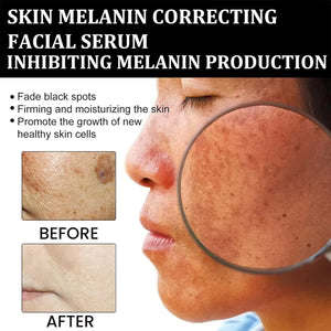 Eelhoe - Melanin Correcting Serum