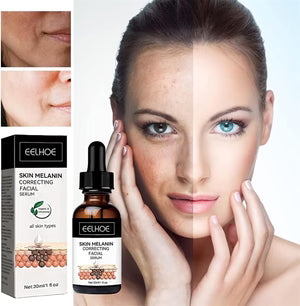 Eelhoe - Melanin Correcting Serum